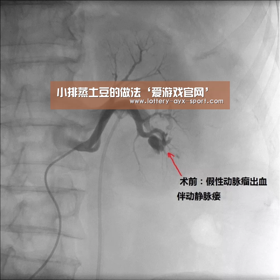 小排蒸土豆的做法‘爱游戏官网’(图1) 爱游戏官网